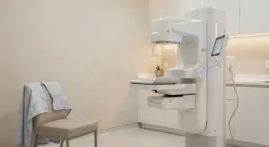 A modern 3D mammography machine in a warm, welcoming medical clinic room for a first mammogram screening.